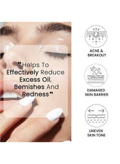 Niacinamide 10% + Zinc Pca 1% Serum For Face Pore Reducer Uneven Skin Tone And Dark Spot Reducer Treat Acne Skin Balancing Reduce Excess Oil & Skin Redness 30ml